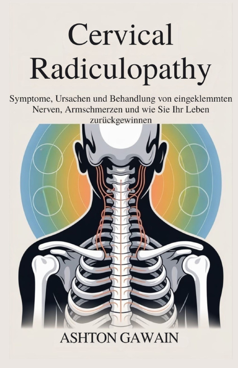 Book Cervical Radiculopathy Ashton Gawain
