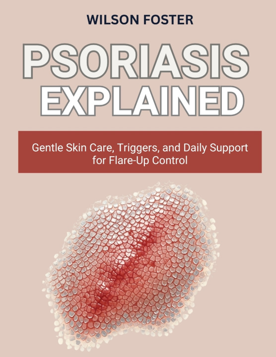 Knjiga PSORIASIS EXPLAINED WILSON FOSTER