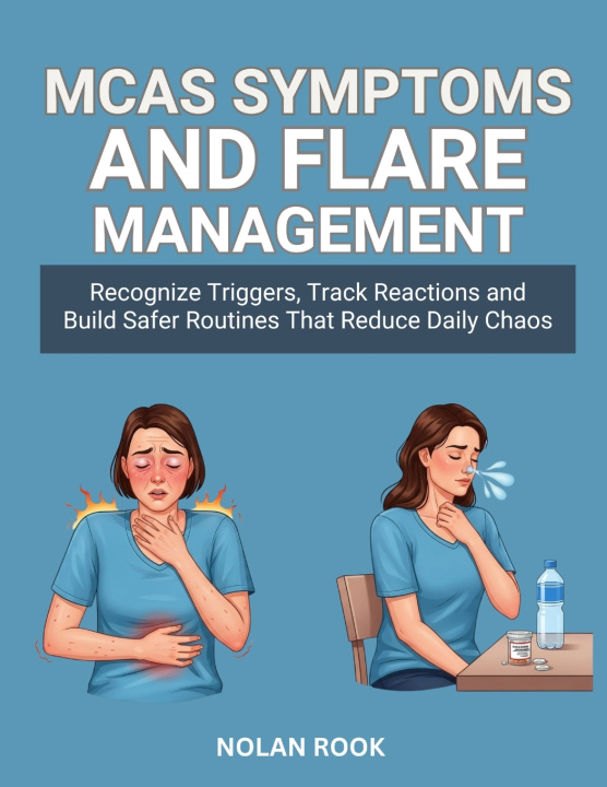 Boek MCAS SYMPTOMS AND FLARE MANAGEMENT WILSON FOSTER