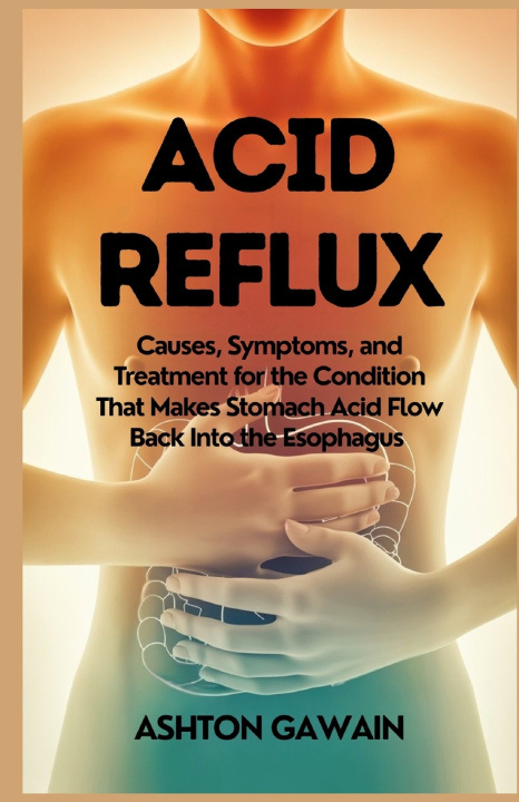 Knjiga Acid Reflux Ashton Gawain