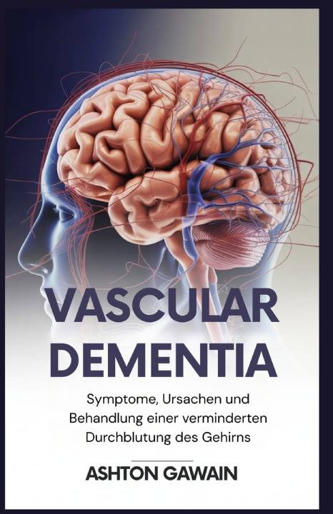 Knjiga Vascular Dementia Ashton Gawain