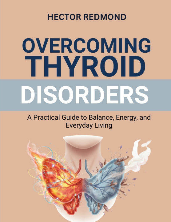 Knjiga Overcoming Thyroid Disorders Hector Redmond