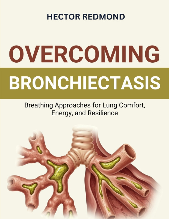 Kniha Overcoming Bronchiectasis Hector Redmond