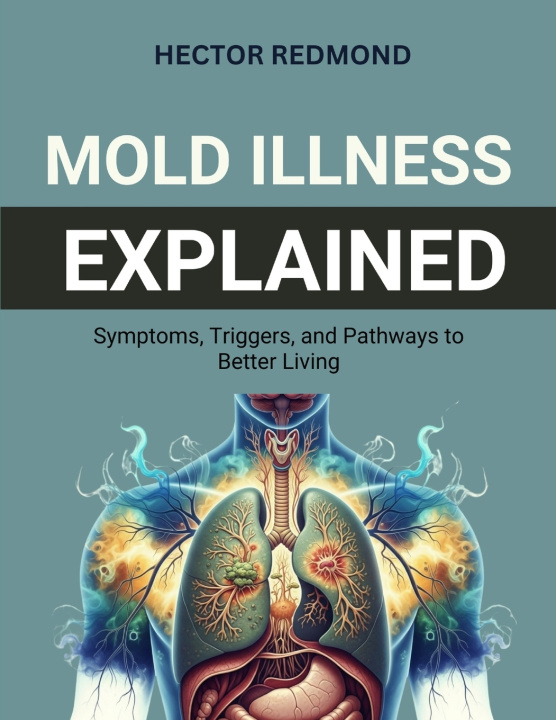 Knjiga Mold Illness Explained Hector Redmond