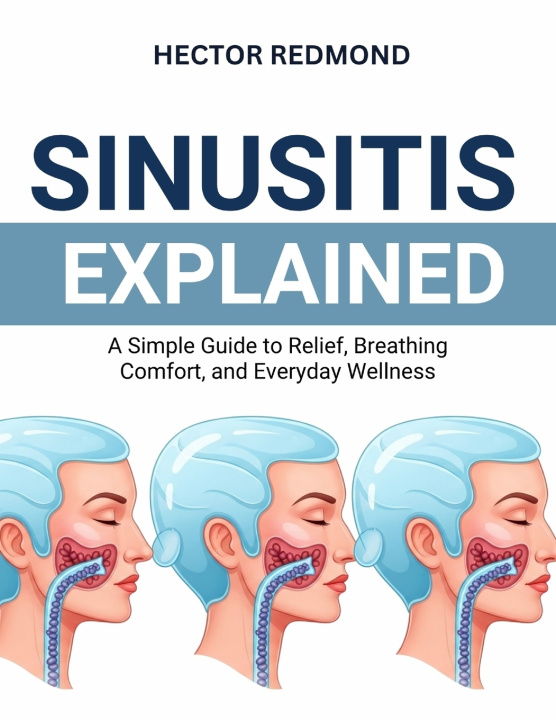 Knjiga Sinusitis Explained Hector Redmond