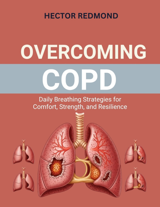 Kniha Overcoming COPD Hector Redmond