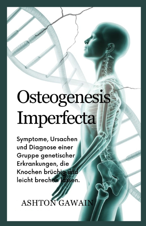 Knjiga Osteogenesis Imperfecta Ashton Gawain