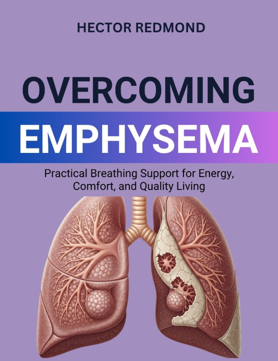 Kniha Overcoming Emphysema Hector Redmond