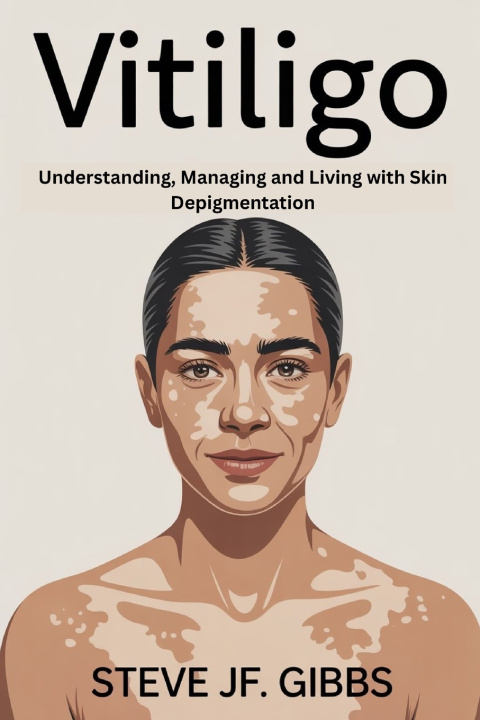 Knjiga Vitiligo Keaton Elias Mercer