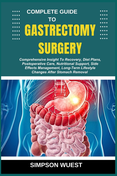 Kniha COMPLETE GUIDE TO GASTRECTOMY SURGERY SIMPSON WUEST