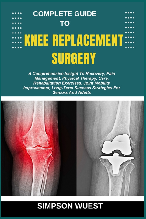 Kniha COMPLETE GUIDE TO KNEE REPLACEMENT SURGERY SIMPSON WUEST
