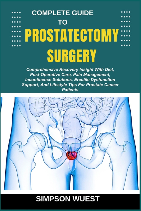 Kniha COMPLETE GUIDE TO PROSTATECTOMY SURGERY SIMPSON WUEST