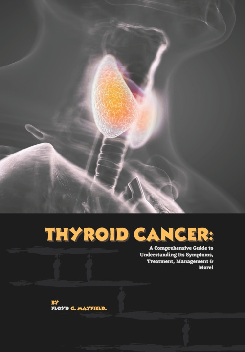 Kniha Thyroid Cancer Floyd C. Mayfield.