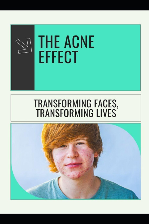 Knjiga The Acne Effect Scarlett Y. Turner