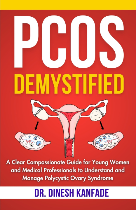 Book PCOS DEMYSTIFIED DR. DINESH KANFADE