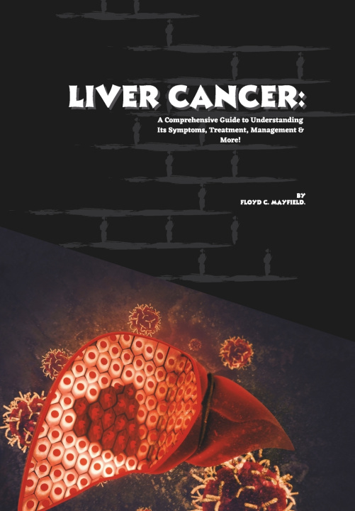Könyv Liver Cancer Floyd C. Mayfield