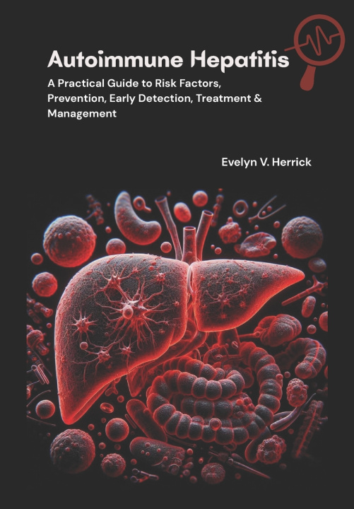 Knjiga Autoimmune Hepatitis Evelyn V. Herrick