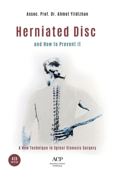 Kniha LUMBAR DISC HERNIATION AHMET Yildizhan