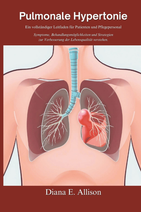Könyv Pulmonale Hypertonie Diana E Allison