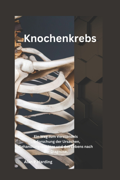 Kniha Knochenkrebs Alan P. Harding