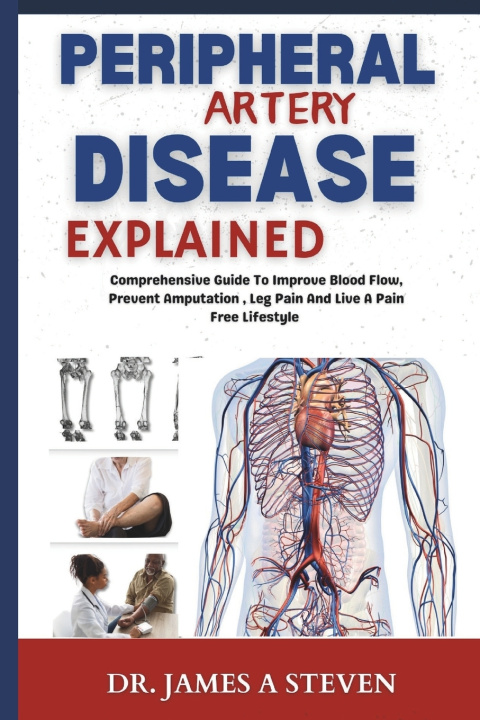 Kniha peripheral Artery Disease Explained James A Steven