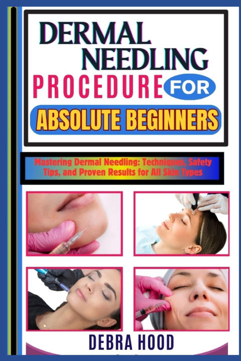 Kniha DERMAL NEEDLING PROCEDURE DEBRA HOOD