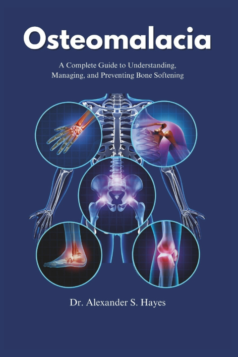 Kniha Osteomalacia Alexander S Hayes