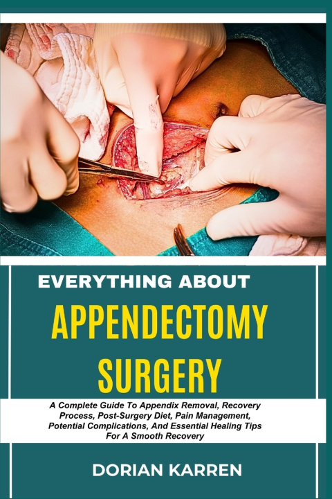 Kniha EVERYTHING ABOUT APPENDECTOMY SURGERY DORIAN KARREN