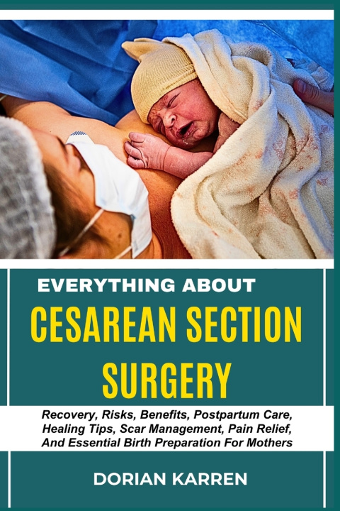 Kniha EVERYTHING ABOUT CESAREAN SECTION SURGERY DORIAN KARREN