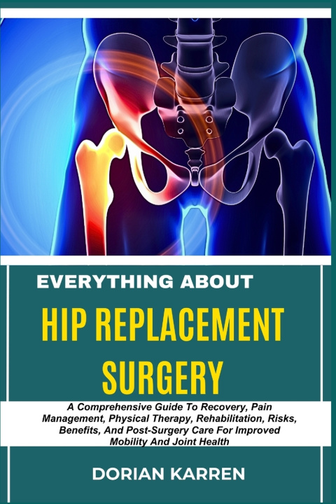 Kniha EVERYTHING ABOUT HIP REPLACEMENT SURGERY DORIAN KARREN