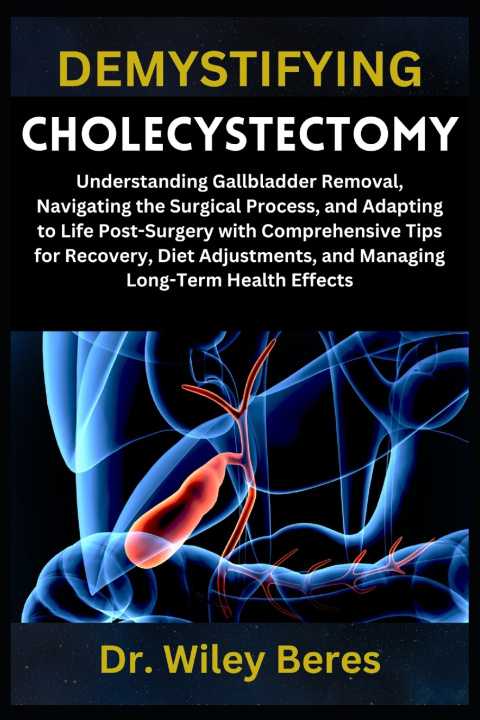 Kniha DEMYSTIFYING CHOLECYSTECTOMY Dr. Wiley Beres