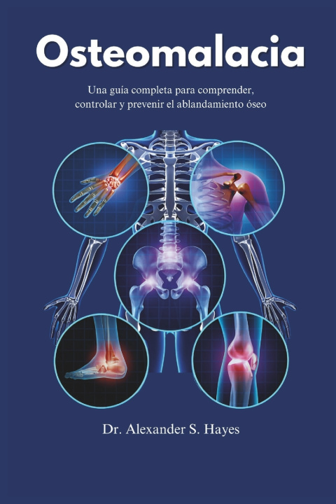 Buch Osteomalacia Alexander S Hayes