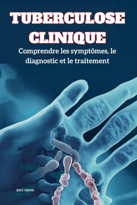 Könyv Tuberculose Clinique Eric Davis