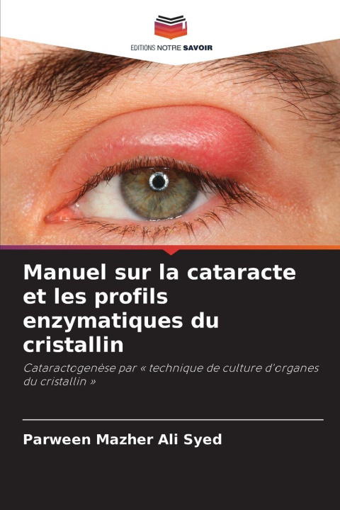 Libro Manuel sur la cataracte et les profils enzymatiques du cristallin Parween Mazher Ali Syed