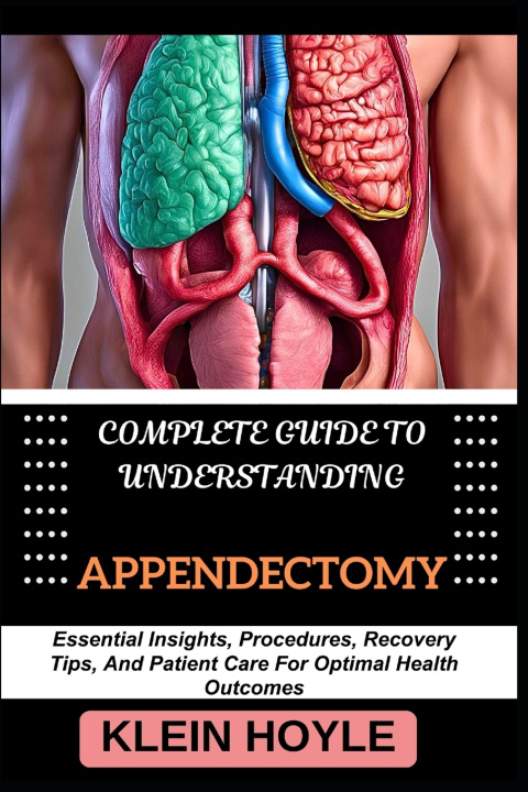 Kniha COMPLETE GUIDE TO UNDERSTANDING APPENDECTOMY KLEIN HOYLE