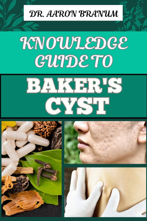 Kniha KNOWLEDGE GUIDE TO BAKER'S CYST DR. AARON BRANUM