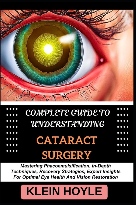 Kniha COMPLETE GUIDE TO UNDERSTANDING CATARACT SURGERY KLEIN HOYLE