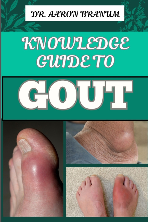 Kniha KNOWLEDGE GUIDE TO GOUT DR. AARON BRANUM