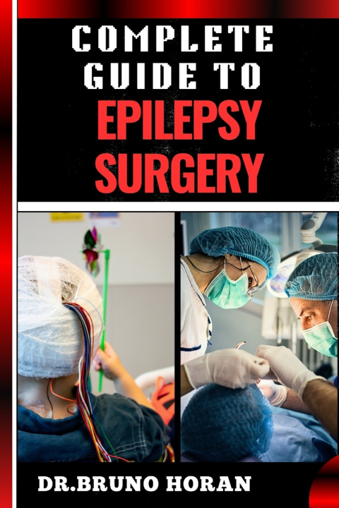 Kniha COMPLETE GUIDE TO EPILEPSY SURGERY DR. BRUNO HORAN