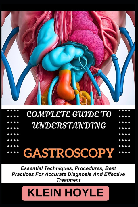 Kniha COMPLETE GUIDE TO UNDERSTANDING GASTROSCOPY KLEIN HOYLE