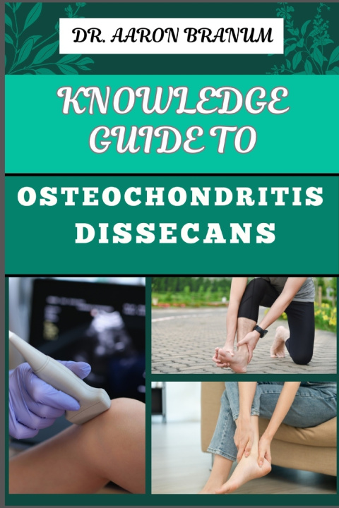 Kniha KNOWLEDGE GUIDE TO OSTEOCHONDRITIS DISSECANS DR. AARON BRANUM