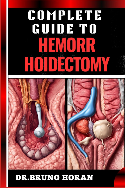 Knjiga COMPLETE GUIDE TO HEMORRHOIDECTOMY DR. BRUNO HORAN