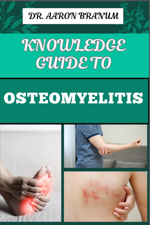 Kniha KNOWLEDGE GUIDE TO OSTEOMYELITIS DR. AARON BRANUM