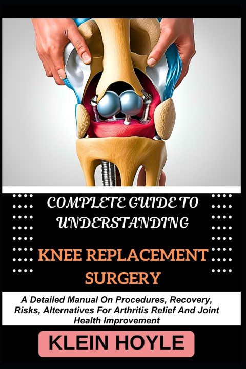 Kniha COMPLETE GUIDE TO UNDERSTANDING KNEE REPLACEMENT SURGERY KLEIN HOYLE