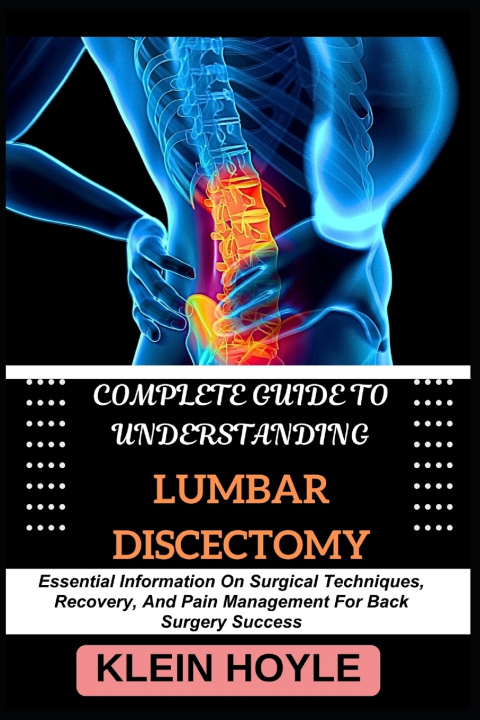 Könyv COMPLETE GUIDE TO UNDERSTANDING LUMBAR DISCECTOMY KLEIN HOYLE