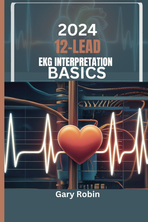 Книга 2024 Lead Ekg Interpretation Basics Gary Robin
