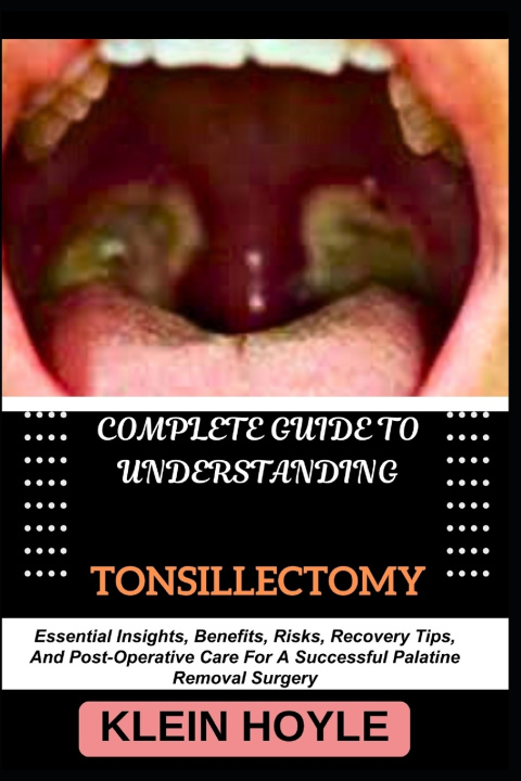 Kniha COMPLETE GUIDE TO UNDERSTANDING TONSILLECTOMY KLEIN HOYLE