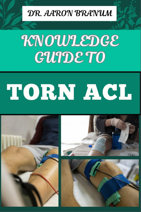 Könyv KNOWLEDGE GUIDE TO TORN ACL DR. AARON BRANUM