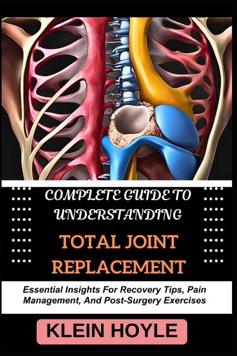 Kniha COMPLETE GUIDE TO UNDERSTANDING TOTAL JOINT REPLACEMENT KLEIN HOYLE