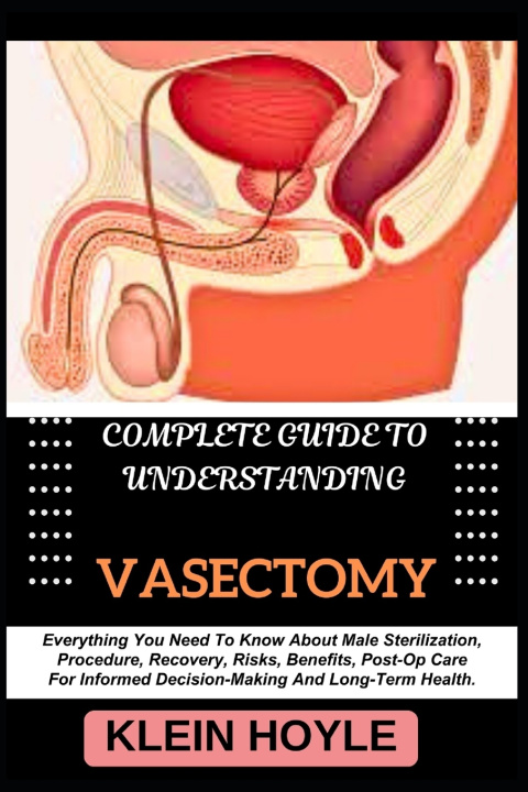Knjiga COMPLETE GUIDE TO UNDERSTANDING VASECTOMY KLEIN HOYLE
